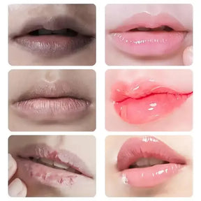 LipBalm- Clareador Labial