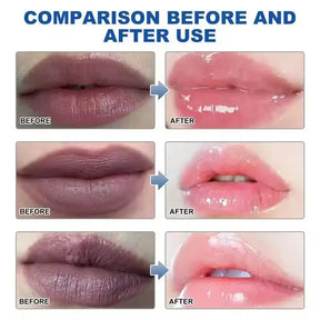 LipBalm- Clareador Labial